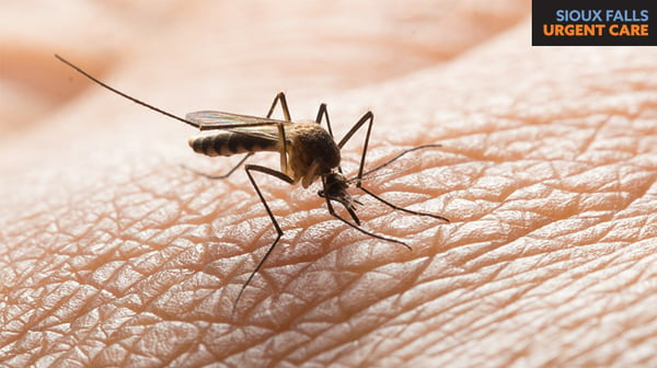 What’s the Buzz?  Everything You Need to Know About West Nile Virus